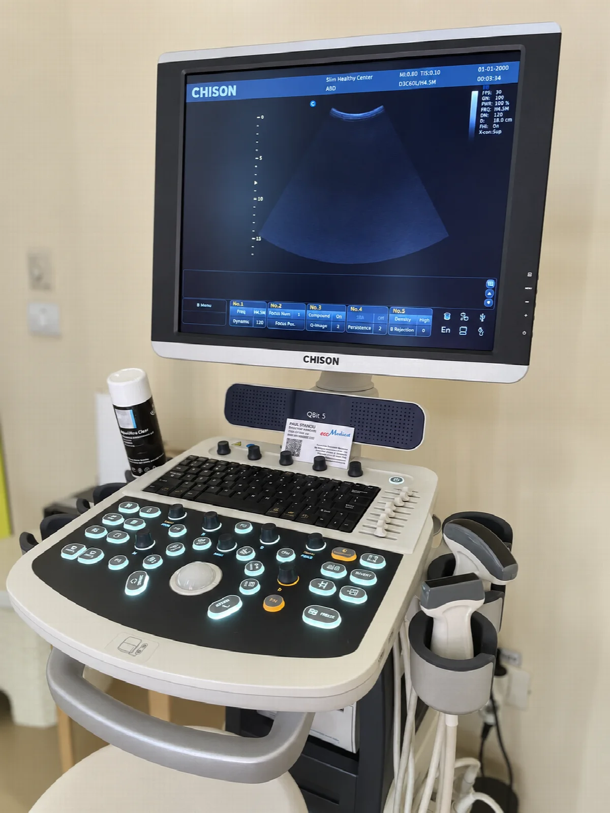 Ecograful CHISON din clinica Slim Healthy Center